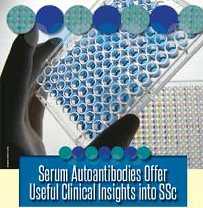 Serum Autoantibodies Offer Useful Clinical Insights into SSc