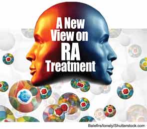 A New View on RA Treatment