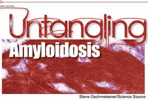 Untangling Amyloidosis