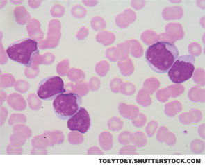 A blood smear is often used as a follow-up test to abnormal results on a complete blood count (CBC) to evaluate the different types of blood cells. 
