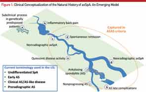 Clinical Conceptualization of the Natural History of axSpA: An Emerging Model