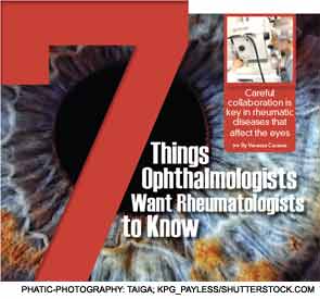 7 Things Ophthalmologists Want Rheumatologists to Know