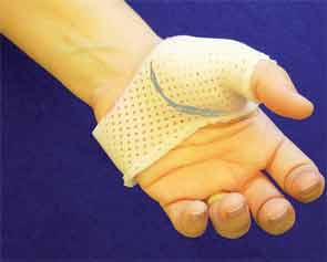 Thumb spica splint.