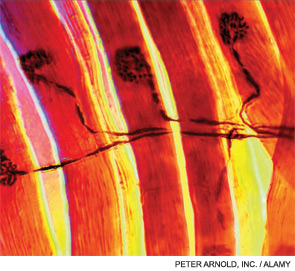 Light micrograph of a neuromuscular junction.