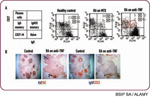 Figure 1: Unexpected effects of TNF blockade on the B-cell compartment in RA.