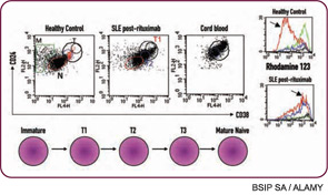 Figure 2: Long-term responders to B cell–depletion therapy in lupus display a unique B cell–reconstitution profile.