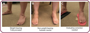 Figure 2: Evaluating the difference between standing (A) and sitting (B) is a critical part of any mechanical evaluation. If the foot can be put into a subtalar neutral position (B) and held there (C), a significant reduction in weight-bearing joint stress and symptoms is possible.