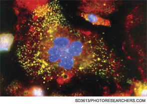 Immunofluorescent light micrograph of active macrophage white blood cells producing cytokine proteins.