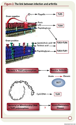 Figure 2: The link between infection and arthritis