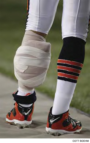 A player wearing an ice pack taped to his leg after an injury.