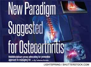 New Paradigm Suggested for Osteoarthritis