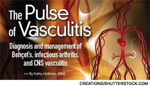 The Pulse of Vasculitis