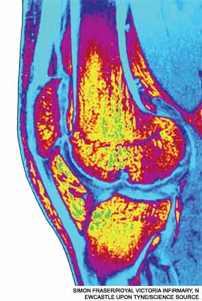 NSAIDs, TNF inhibiotrs, and biologics may all be important treatments for spondylarthropies.