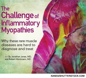 The Challenge of Inflammatory Myopathies