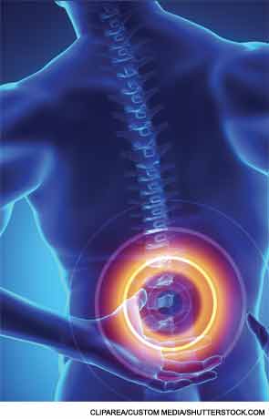 Spondylarthritis