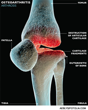 Osteoimmunology