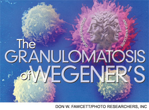 The Granulomatosis of Wegener's