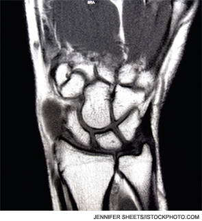 Wrist MRI